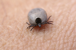 Tick season predicted to be worst in years