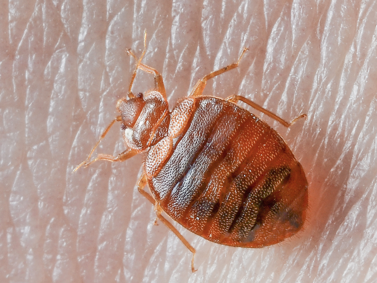 Bed Bug On Skin 