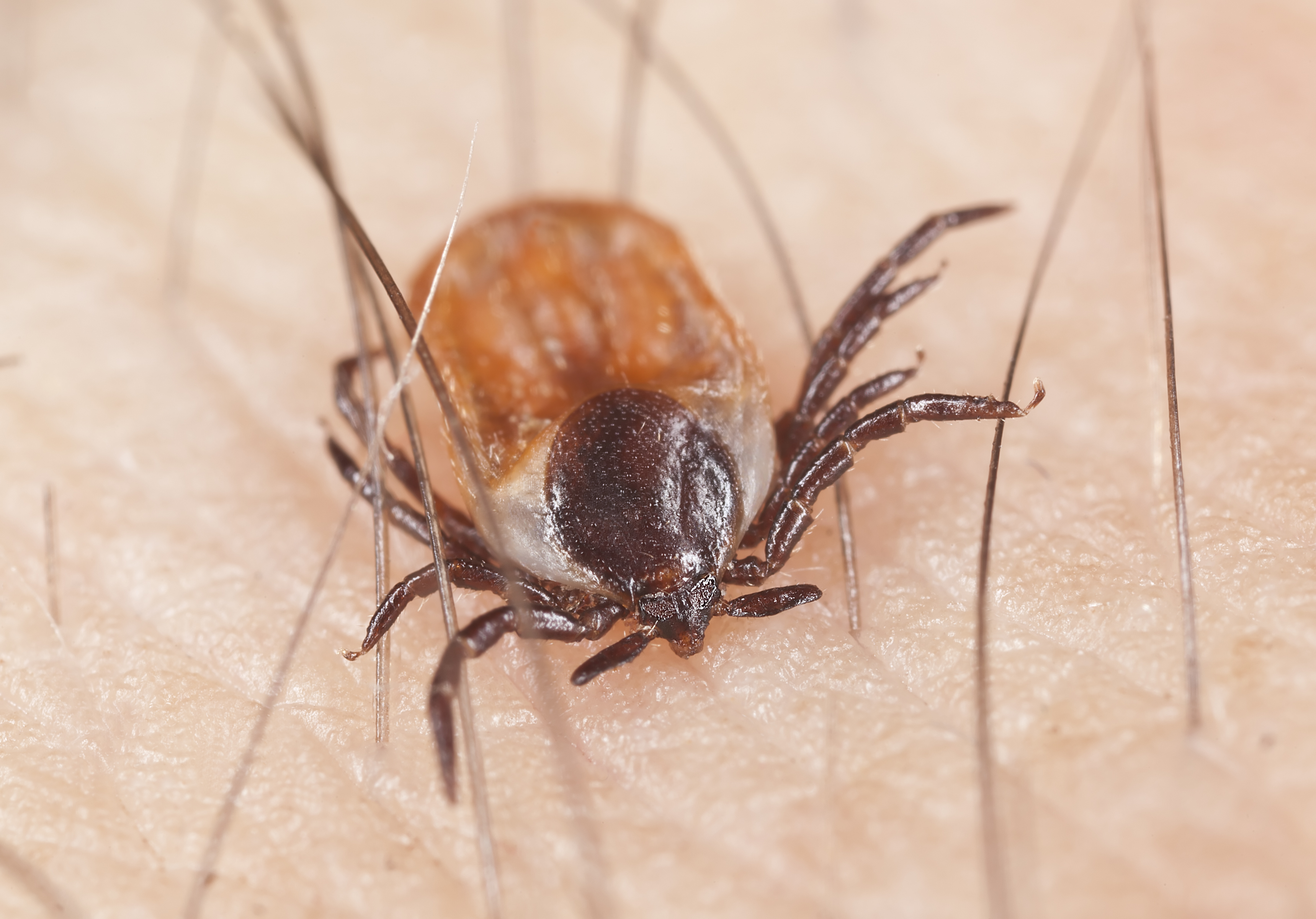 How To Safely Easily Remove Ticks Using Tweezers   Istock 000018801599 Large 